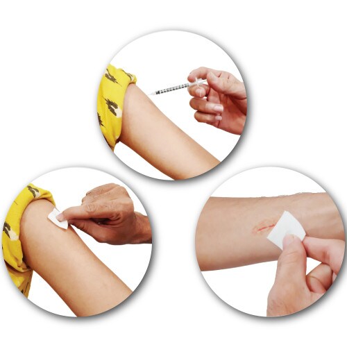 Ultracare Alcohol Prep Pads - 100ct